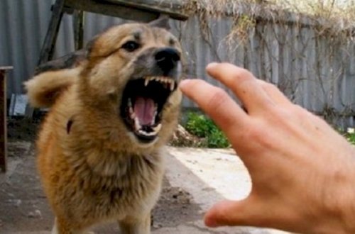 Bakıda sahibsiz it qadına hücum etdi