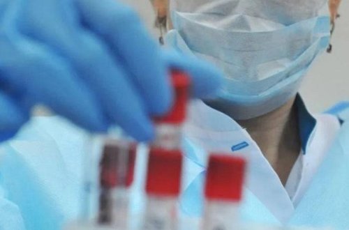 Azərbaycanda daha 106 nəfər koronavirusa yoluxub, 59 nəfər sağalıb, 2 nəfər ölüb