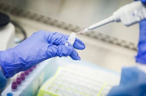 Azərbaycanda koronavirusa yoluxanların ən çox olduğu bölgə açıqlandı - RƏSMİ