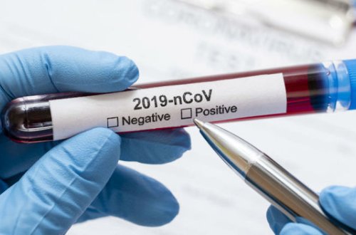 Koronavirusla bağlı SON STATİSTİKA