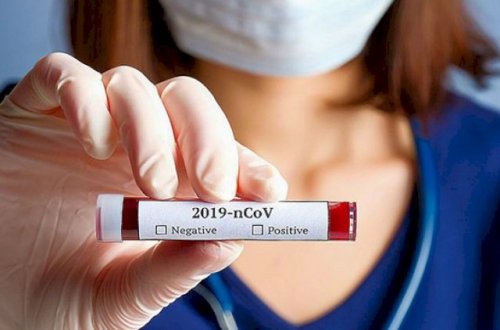 Virusa inanmayanlar üçün: Ölən 100 min nəfərin adı açıqlandı