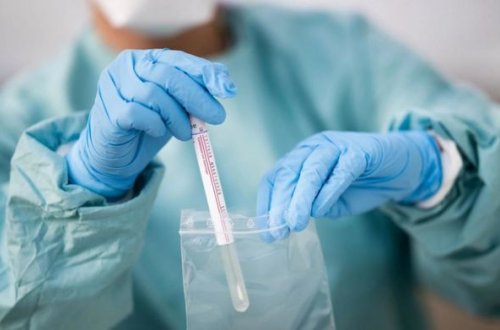 Azərbaycanda daha 149 nəfər koronavirusa yoluxdu, 134 nəfər sağaldı, 2 nəfər öldü