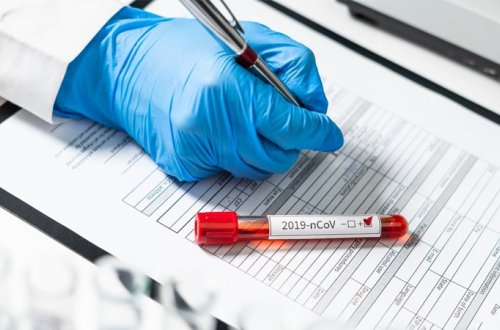 Azərbaycanda bir kənddə 21 nəfər virusa yoluxdu