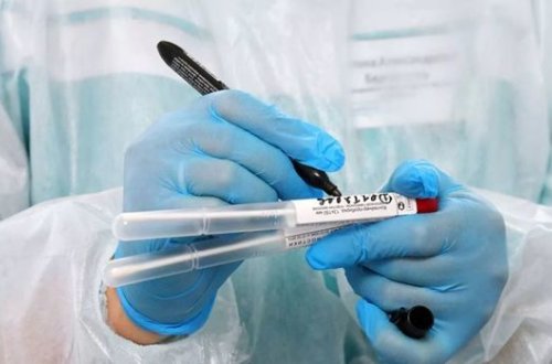 Обнародованы результаты тестов на коронавирус сотрудников телеканала ATV