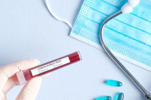 Azərbaycanda daha 132 nəfər koronavirusa yoluxdu, 78 nəfər sağaldı, 1 nəfər öldü