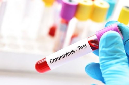 Koronavirusdan ölənlərin sayı 350 mini keçdi