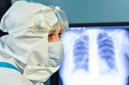 Moskvada son sutka koronavirusdan 76 nəfər dünyasını dəyişib