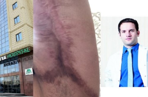 “Avrasiya” klinikasında gənc xanımı şikəst etdilər: daha bir estetik əməliyyat qurbanı-ŞOK GÖRÜNTÜLƏR