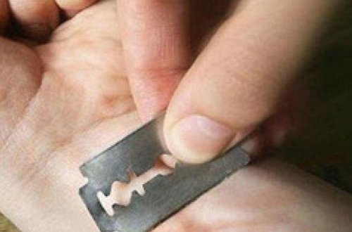 18 yaşlı oğlan ülgüclə qollarını doğradı