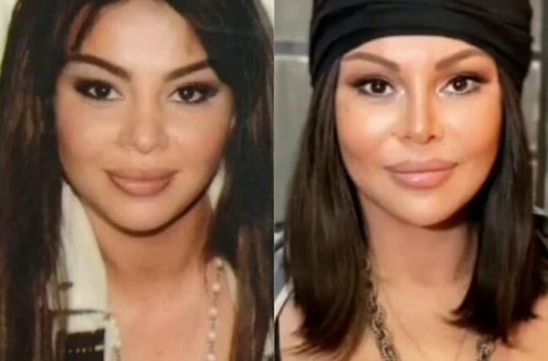 Aygün Kazımovanı illər dəyişdirə bilmədi - BU FOTO HƏR KƏSİ ŞOKA SALDI
