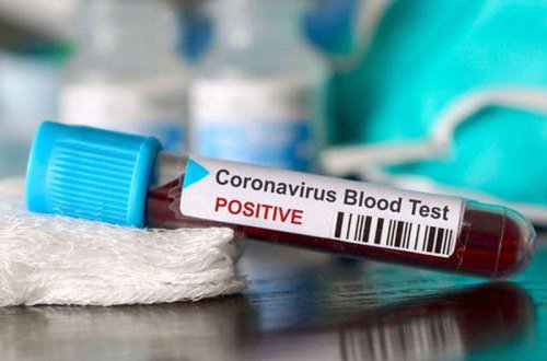 Azərbaycanda daha 273 nəfərdə koronavirus aşkarlanıb - 3 nəfər vəfat edib, 56 nəfər sağalıb