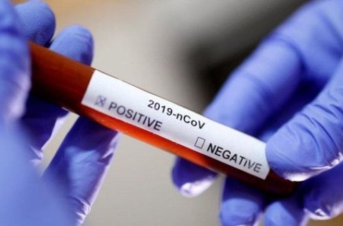 Koronavirusla bağlı son STATİSTİKA