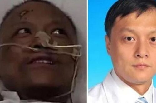 Koronavirusa görə dərisinin rəngi dəyişən həkim öldü