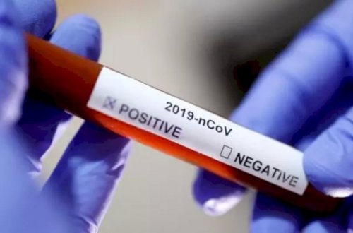 Ermənistanda bir gündə 697 nəfərdə koronavirus aşkarlandı