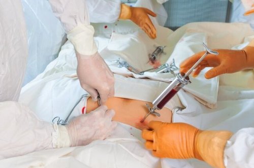 18 yaşına çatmayanlardan sümük iliyi və kök hüceyrələrinin transplantasiyasına icazə veriləcək
