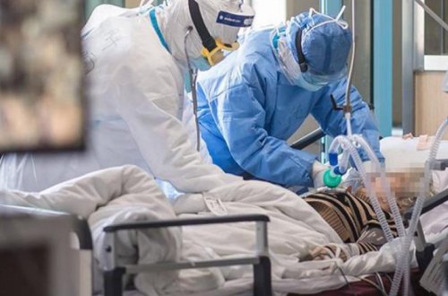 В Азербайджане 100 зараженных коронавирусом находятся в реанимации – ФОТО