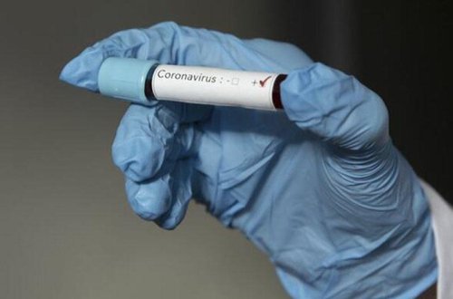 SON DƏQİQƏ: Azərbaycanda yüzlərlə şəxs koronavirusa yoluxdu, ÖLƏNLƏR VAR - Rekord GÖSTƏRİCİ