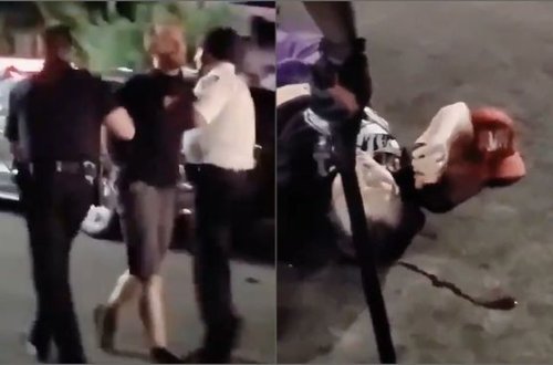 Aksiya zamanı polis gənc müəllimin başını yardı - VİDEO