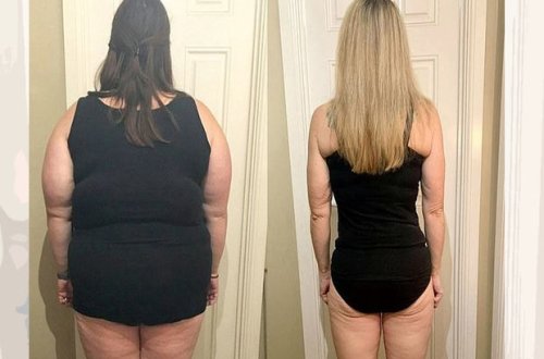 76 kq arıqlayan qadın 18 illik arzusunu gerçəkləşdirdi – FOTO