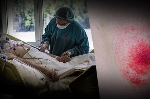 Azərbaycanın qonşusunda yeni dəhşətli virus yayılır - KORONAVİRUSU UNUDUN!