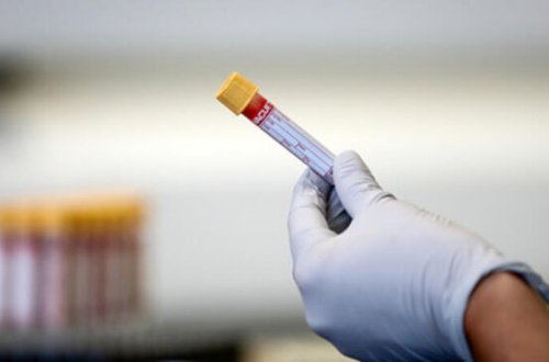 Tanınmış infeksionistdən virusun ikinci dalğası barədə SOS: 