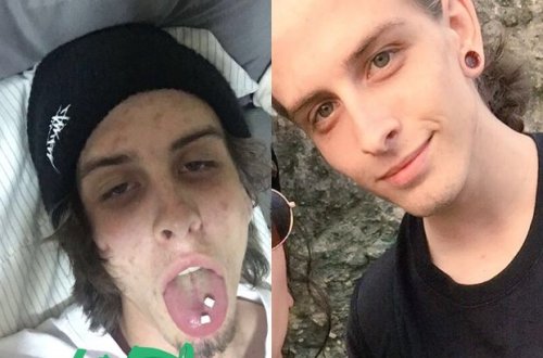 Narkotik asılılığından qurtulan gənc görünüşü ilə təəccübləndirdi - FOTO