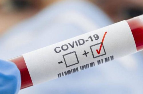 Azərbaycanda daha 352 nəfərdə COVID-19 aşkarlanıb, 6 nəfər vəfat edib, 210 nəfər sağalıb