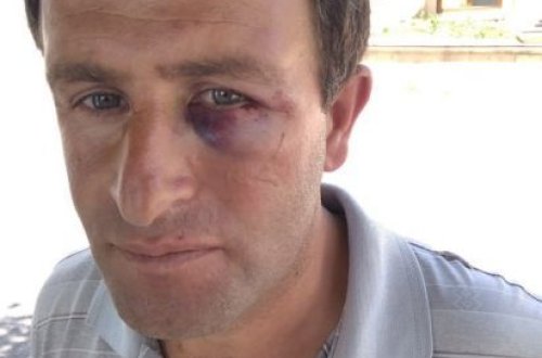 Daşkəsəndə məmur vətəndaşı döydü — VİDEO