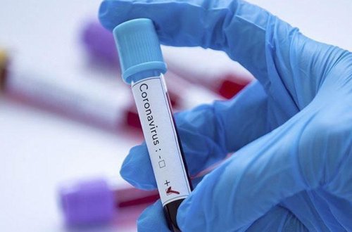 Qırğızıstanda koronavirusa yoluxanların sayı artıb