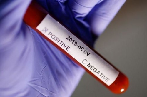 В Азербайджане за сутки коронавирусом заразились 336 человек, еще пятеро скончались