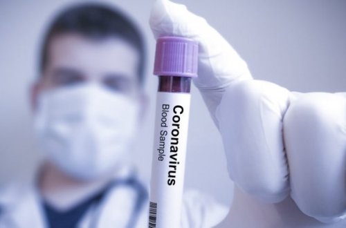 Обнародованы последние данные по COVID-19 - ФОТО