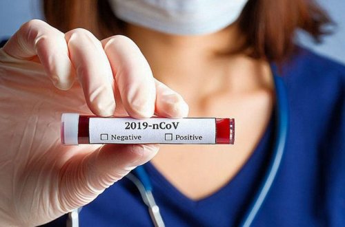 Daha 352 nəfərdə koronavirus aşkarlandı, 2 nəfər öldü, 196 nəfər sağaldı
