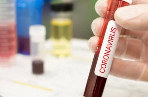 Rusiyada koronavirusdan ölənlərin sayı 7 mini keçdi