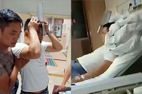 Başında qiyməkeşlə xəstəxanaya gəldi, hər kəsi şoka saldı - FOTO/VİDEO