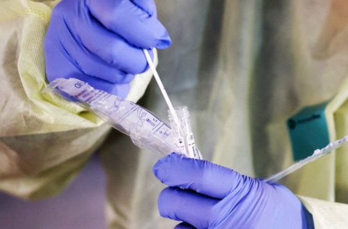 В институте НАНА прокомментировали информацию об инфицировании ученого COVID-19 - ФОТО