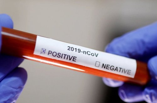 Шесть сотрудников AzTV заразились коронавирусом