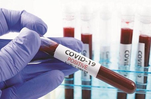 Azərbaycanda 127 nəfər müalicə olunaraq sağalıb və evə buraxılıb