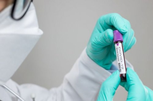 Azərbaycanda koronavirusa yoluxan tibb işçilərinin sayı artıb – Xaçmazda vəziyyət… – AÇIQLAMA