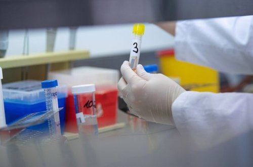 Daha bir TƏBİB rəsmisinin anası koronavirusa yoluxdu