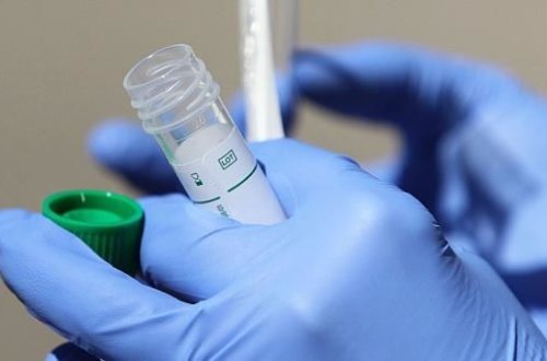 Bakıda koronavirus testi neqativ çıxdı, pozitiv təqdim etdilər - FOTO