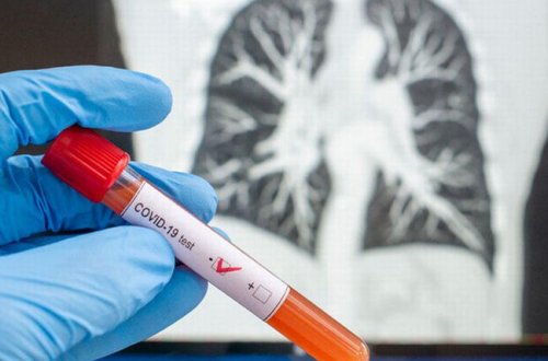 Koronavirusdan sağalan yaşlı insanlar gələcəkdə tez yorula, hətta, hərəkətsiz qala bilər - Araşdırma