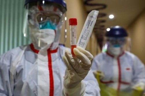 Bakıda iqtisadçı ad günündə koronavirusdan öldü: Anası dözmədi, ürəyi dayandı - FOTO