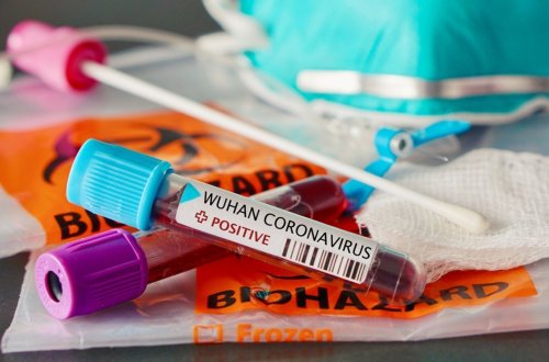 Dünyada koronavirusun ən çox təhlükə törətdiyi ölkələr - SİYAHI