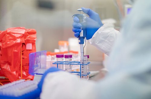 Daha bir məktəb direktoru koronavirusa yoluxdu