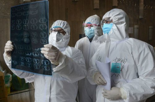 Alimlər koronavirus xəstələrində ömürlük qala biləcək fəsadları açıqladı