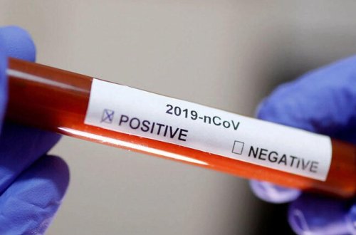 Qırğızıstanda koronavirusa rekord sayda yoluxma qeydə alındı