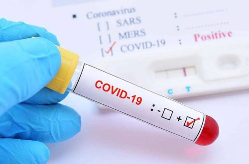 Bu əlamətlərdən biri varsa, təcili COVİD-19 analizi verin