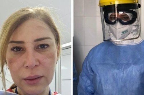 Bakıda pandemiya xəstəxanasının həkimi: “Rentgenə baxırsan, pasiyentin ağciyərləri, sadəcə, yoxdur” - FOTO