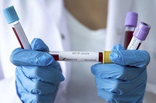 Azərbaycanda daha bir vəzifəli şəxs koronavirusa yoluxdu