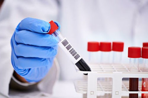 В Азербайджане выявлено 547 новых случаев инфицирования COVID-19, шесть человек скончались